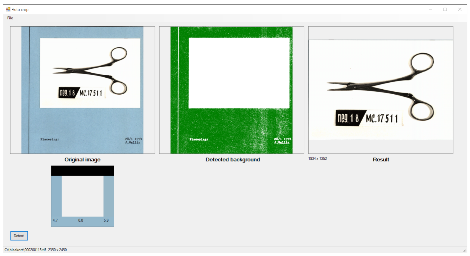 Cropping-Tool-Medicinsk Cropping-Tool-Medicinsk